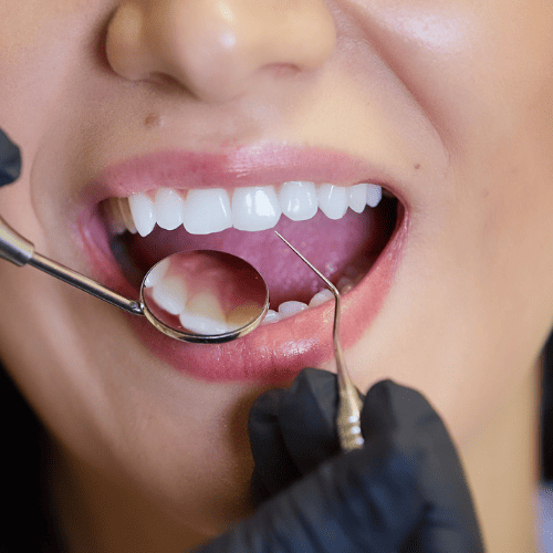 brackets-y-sonrisas-galery6
