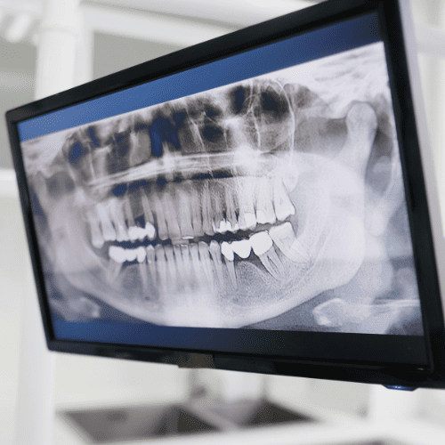 brackets-y-sonrisas-galery9